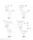 Fig. 03 - Splice-region antisense composition and method