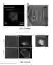 Fig. 07 - Somatic cell nuclear transfer methods