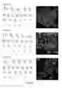 Fig. 08 - Somatic cell nuclear transfer methods