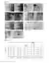 Fig. 04 - METHOD OF SCREENING GENE FOR 1,4-BDO PRODUCTION