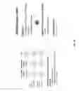 Fig. 85 - Methods and systems for tumor detection