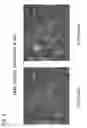 Fig. 09 - Focal gene expression profiling of stained FFPE tissues with spatial correlation to morphology