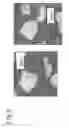 Fig. 10 - SPHERICAL DIAMOND AND MANUFACTURING METHOD FOR SAME