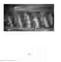Fig. 08 - KINK-RESISTANT ELECTROSPUN FIBER MOLDS AND METHODS OF MAKING THE SAME