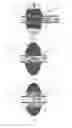 Fig. 03 - Method for hydraulic fracturing (variants)