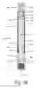 Fig. 07 - Removable piston rod sleeve for fluid pump