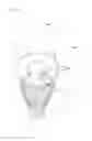 Fig. 09 - Lighting device