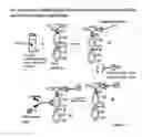 Fig. 14 - METHODS FOR USING ANTIBODIES AND ANALOGS THEREOF
