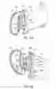 Fig. 71 - Rotatable magnet methods and apparatus for a magnetic resonance imaging system
