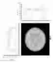 Fig. 06 - Light diffusing devices for use in photoimmunotherapy