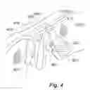 Fig. 04 - CUSTOM FIT NOSE PADS FOR SPECTACLE FRAMES
