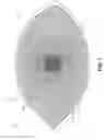 Fig. 02 - Micro fenestrated contact lens