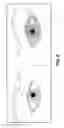Fig. 05 - Micro fenestrated contact lens