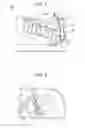 Fig. 02 - Fixing device for suppressing reduced durability of a flexible rotary member