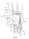 Fig. 13 - Fluid control valve having discrete flow channels arranged to equalize the velocity of fluid at the perimeter of the valve port