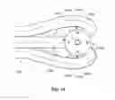 Fig. 14 - Fluid control valve having discrete flow channels arranged to equalize the velocity of fluid at the perimeter of the valve port