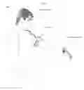 Fig. 02 - Remote perception of depth and shape of objects and surfaces