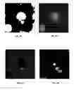 Fig. 04 - NON-LINEAR IMAGING SYSTEMS AND METHODS FOR ASSISTED REPRODUCTIVE TECHNOLOGIES