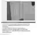 Fig. 01 - Adaptive lane marker detection for a vehicular vision system