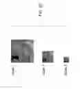 Fig. 05 - Denoising medical images by learning sparse image representations with a deep unfolding approach