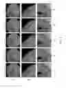 Fig. 08 - Denoising medical images by learning sparse image representations with a deep unfolding approach