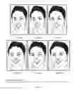 Fig. 19 - Systems and methods of managing treatment of a chronic condition by symptom tracking