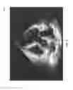 Fig. 06 - Methods and systems for hierarchical machine learning models for medical imaging