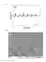Fig. 20 - NANOFIBER WEB PIEZOELECTRIC MATERIAL OBTAINED BY ELECTROSPINNING POLYLACTIC ACID, METHOD OF PRODUCING SAME, PIEZOELECTRIC SENSOR COMPRISING SAME, AND METHOD OF MANUFACTURING THE PIEZOELECTRIC SENSOR