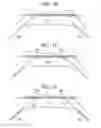 Fig. 09 - Methods for manufacturing ultrasound transducers and other components