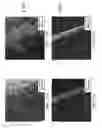 Fig. 22 - Regenerative polysulfide-scavenging layers enabling lithium-sulfur batteries with high energy density and prolonged cycling life and methods of making same