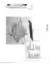 Fig. 30 - Radar lens antenna arrays and methods