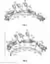 Fig. 04 - Distributed connection ring assembly for stator assembly