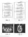 Fig. 03 - Image fingerprinting