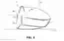 Fig. 11 - Golf club head