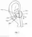 Fig. 04 - Ear tip with anti-tragus stabilizer