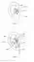 Fig. 07 - Ear tip with anti-tragus stabilizer