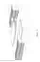 Fig. 04 - Thermal Module