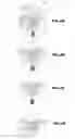 Fig. 05 - Apparatus for securing electronic devices on a carrier during transportation