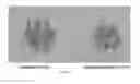 Fig. 19 - Non-GM improved crops and methods for obtaining crops with improved inheritable traits