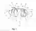 Fig. 02 - Hip lift animal harness device
