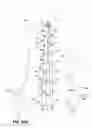 Fig. 32 - Article of clothing having magnetic fastening assemblies