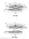 Fig. 34 - Article of clothing having magnetic fastening assemblies