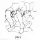 Fig. 04 - RESILIENT BAND AND METHOD FOR USING SAME TO PREVENT CLOTHING FROM CONTACTING UNSANITARY SURFACES