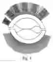 Fig. 06 - Artificial lash extensions