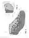 Fig. 05 - Hybrid braided article