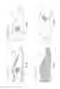 Fig. 25 - Last for an article of footwear