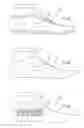 Fig. 26 - Last for an article of footwear