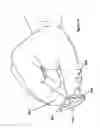 Fig. 12 - TRAVEL SIZE DEODORANT DISPENSER
