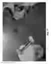 Fig. 11 - Cleaning device and methods for use