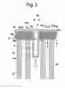 Fig. 04 - Interchangeable brush head with ultrasound action